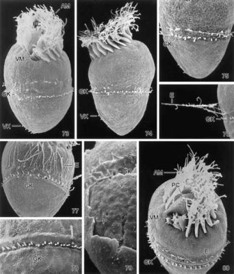  Strombidium: Un champion du camouflage vivant dans un monde microscopique de mouvements incessants!